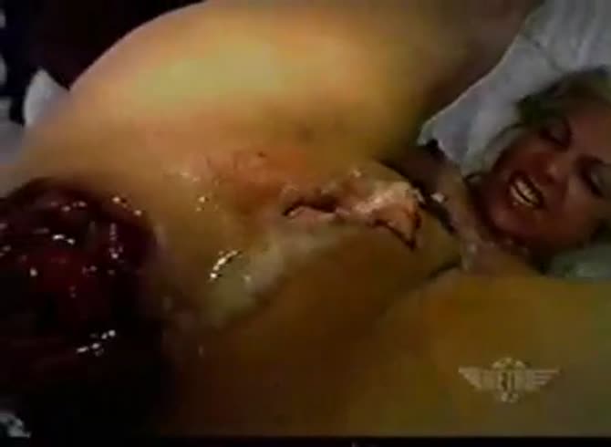 Video :Extremely horny slut got her swollen asshole creampied 